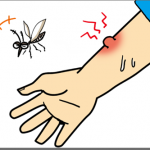 蚊に刺されると腫れるのはなぜ？その対処はどうすればいいの？